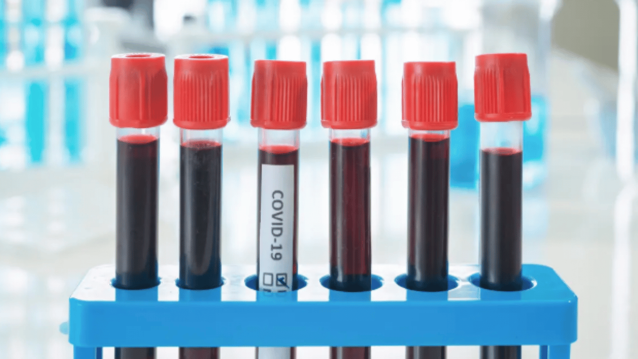 Foto - Diyabete en yatkın kan grubu belli oldu! Bilim insanları açıkladı!