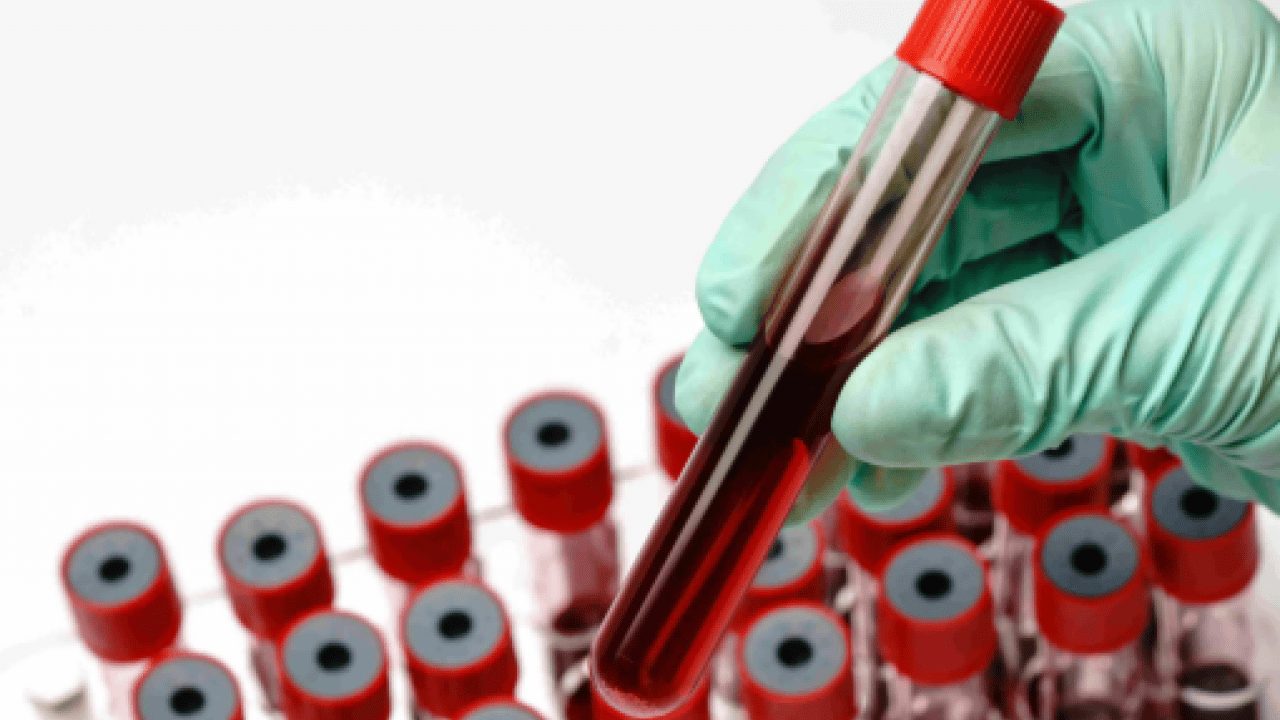 Foto - Diyabete en yatkın kan grubu belli oldu! Bilim insanları açıkladı!