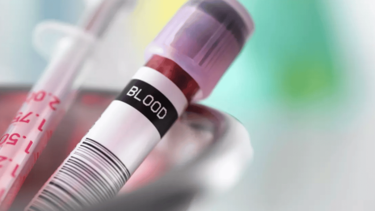 Diyabete en yatkın kan grubu belli oldu! Bilim insanları açıkladı!