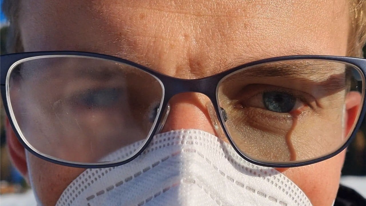 Bu kış rahat edeceksiniz! Gözlüklerin buğulanmasını önleyen yöntem açıklandı