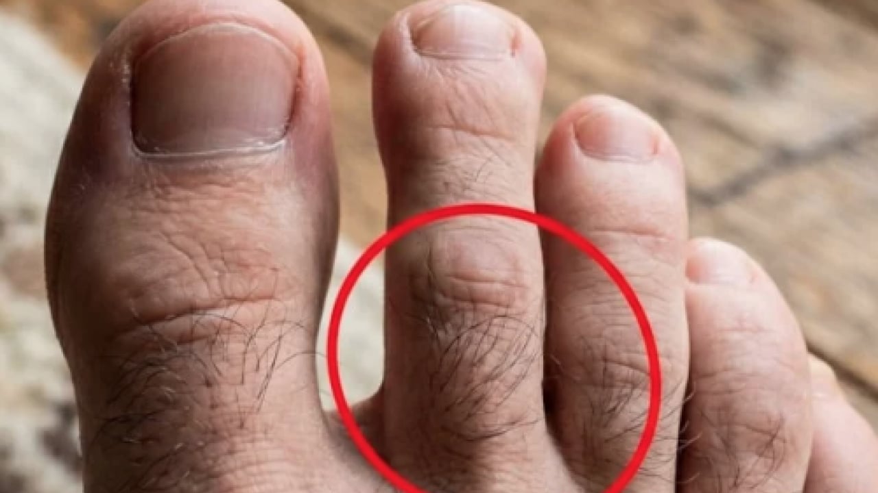 Foto - Bu küçük tüyler... Ayaklarınızda kıllarınız varsa yaşadınız! Dikkat edin yoksa... Sadece büyüyor mu?