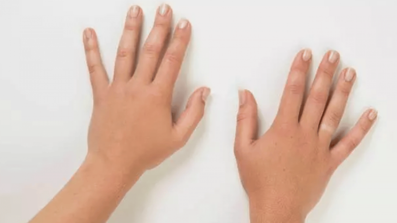 Foto - Bu ülkelere akıl sır ermiyor: Vakti geleni ölüme terk ediyorlar!