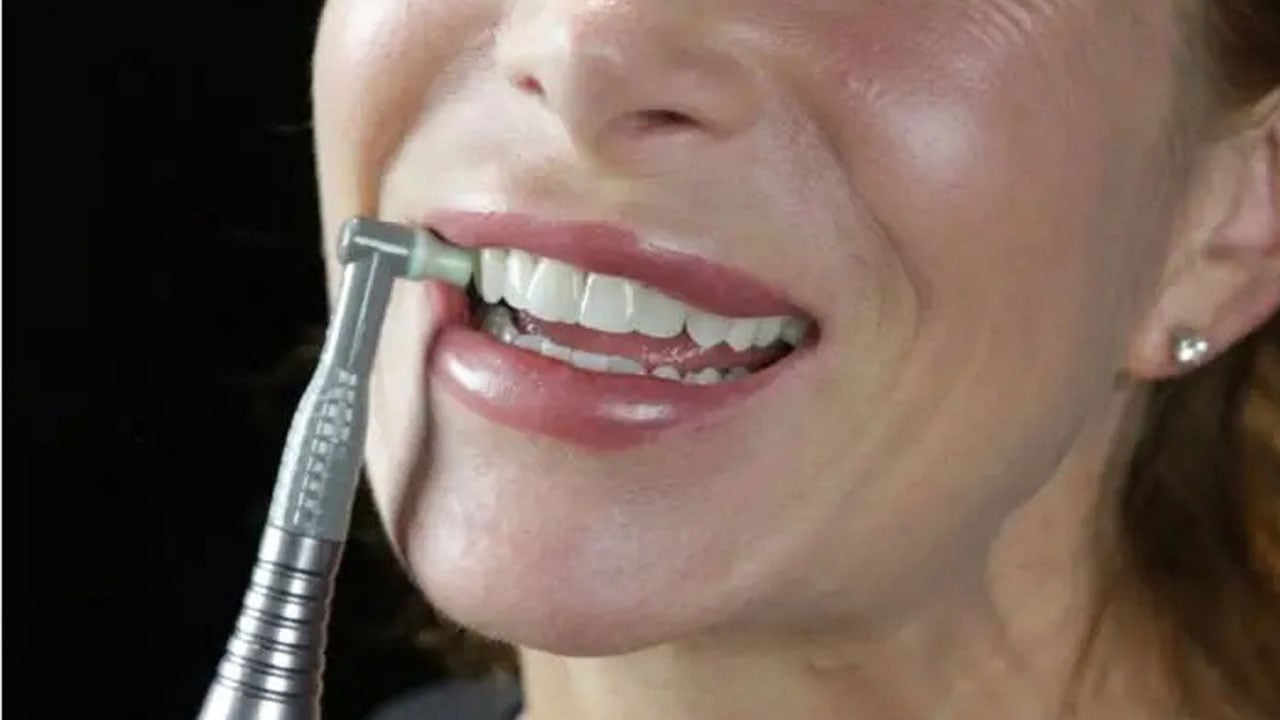 Foto - Bu ürünler dişleriniz için yıkım olabilir! Beyazlatıyor diye kullanılıyor, sonuç hüsran oluyor