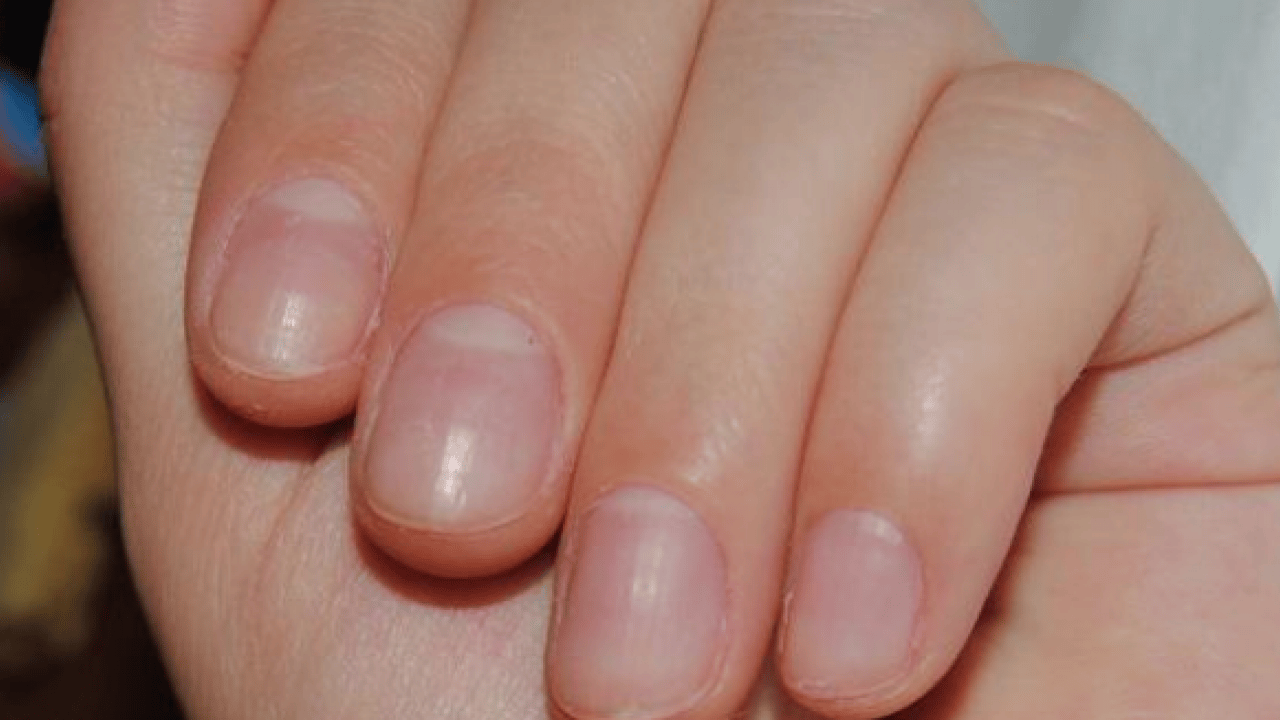 Foto - Bu uyarıya kulak verilmeli: Dalgalı tırnak bakın neyin habercisi! Vücut böyle alarm veriyor...