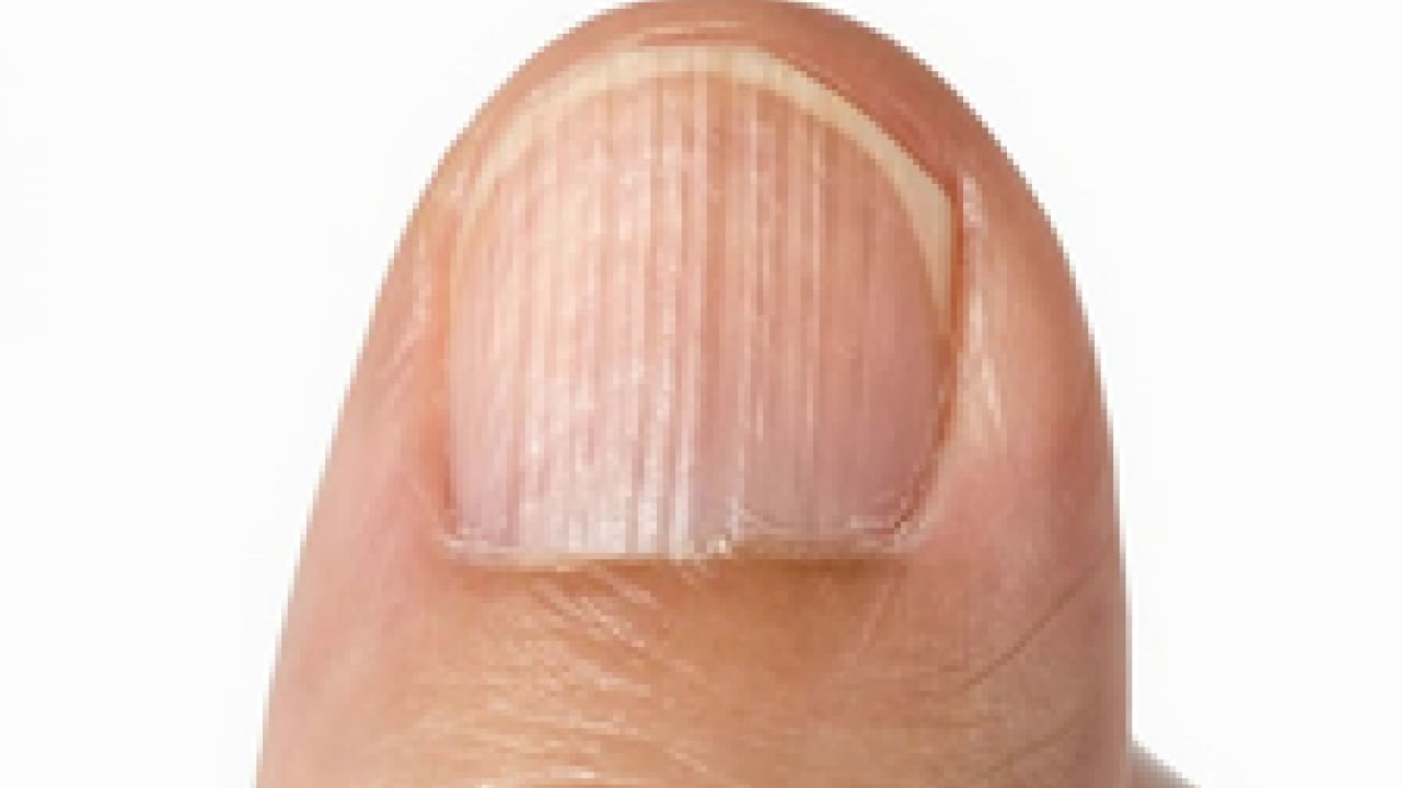 Foto - Bu uyarıya kulak verilmeli: Dalgalı tırnak bakın neyin habercisi! Vücut böyle alarm veriyor...