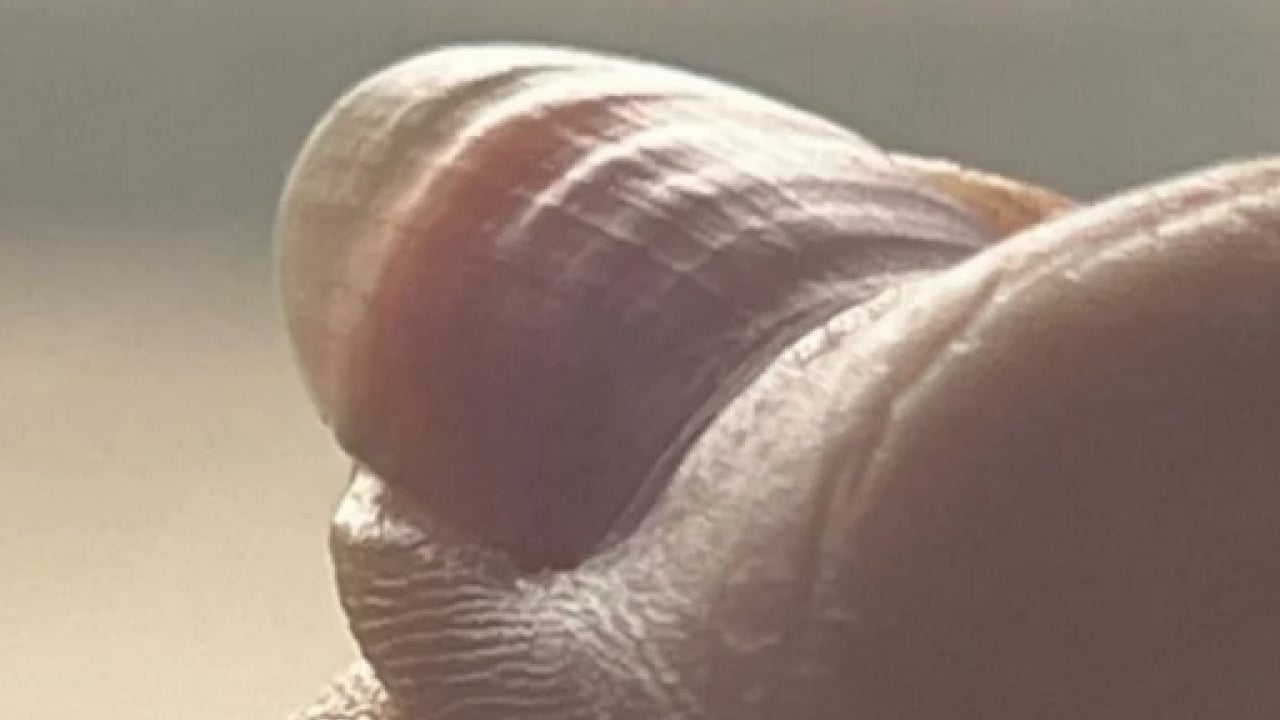 Foto - Bu uyarıya kulak verilmeli: Dalgalı tırnak bakın neyin habercisi! Vücut böyle alarm veriyor...