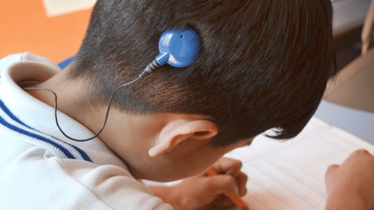 Bu yöntem ile tamamen duracak! Koklear İmplant ile bebekler de yaşlılar da duyabiliyor