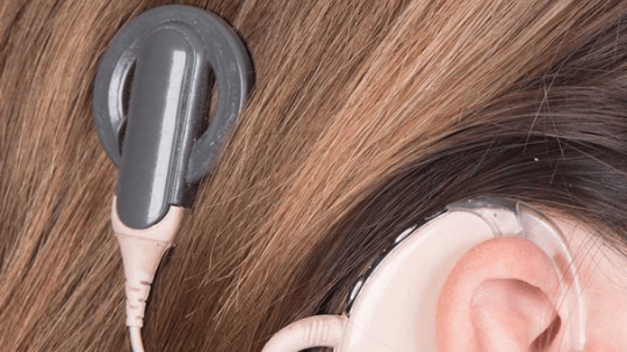 Foto - Bu yöntem ile tamamen duracak! Koklear İmplant ile bebekler de yaşlılar da duyabiliyor