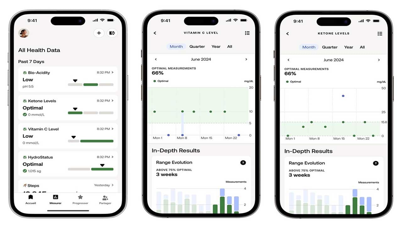 Foto - Bunu da gördük! Evde idrar tahlili