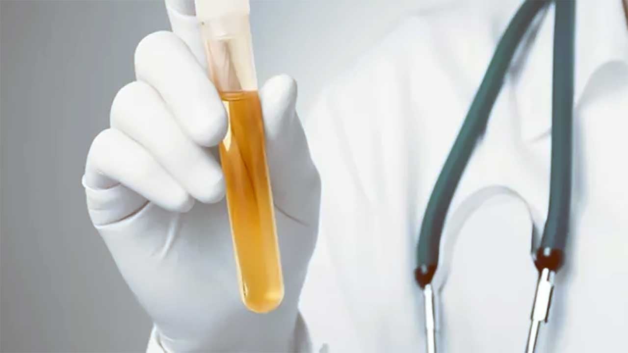 Bunu da gördük! Evde idrar tahlili