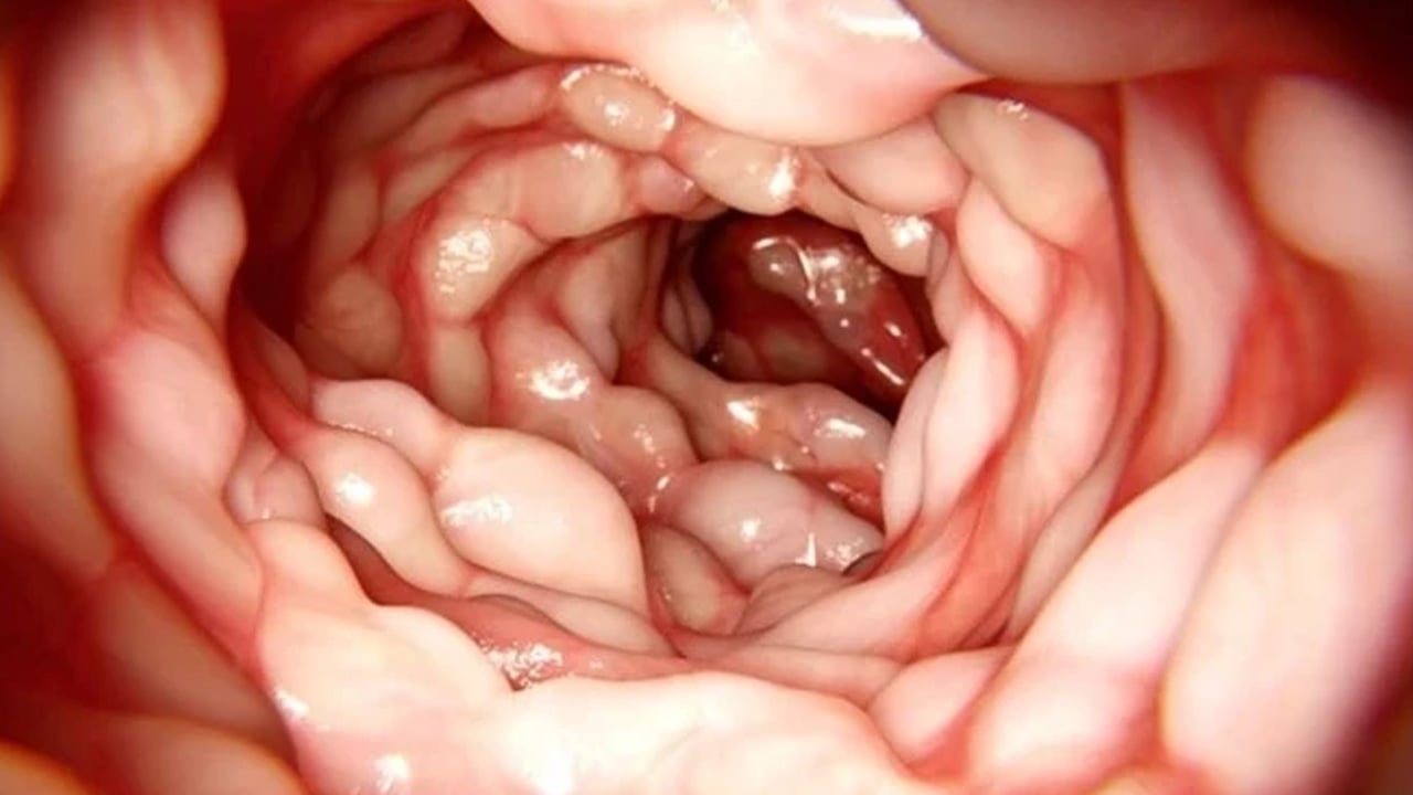 Foto - Bunu hiç kimse bilmiyor: Bitki bazlı beslenme kilo kaybına neden oluyor! İşte son durumu açıkladılar