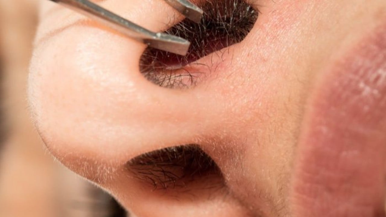 Foto - Burun kılını çeken genç hayatını kaybetti!