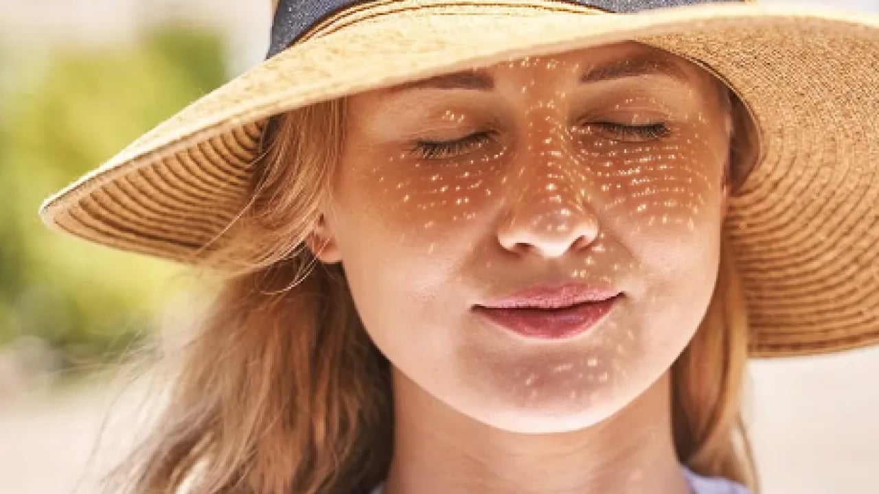 Foto - Büyük sıkıntı olabilir: Hangi mezoterapi yöntemleri peki! Güneş lekesi tedavisi her dönemde...