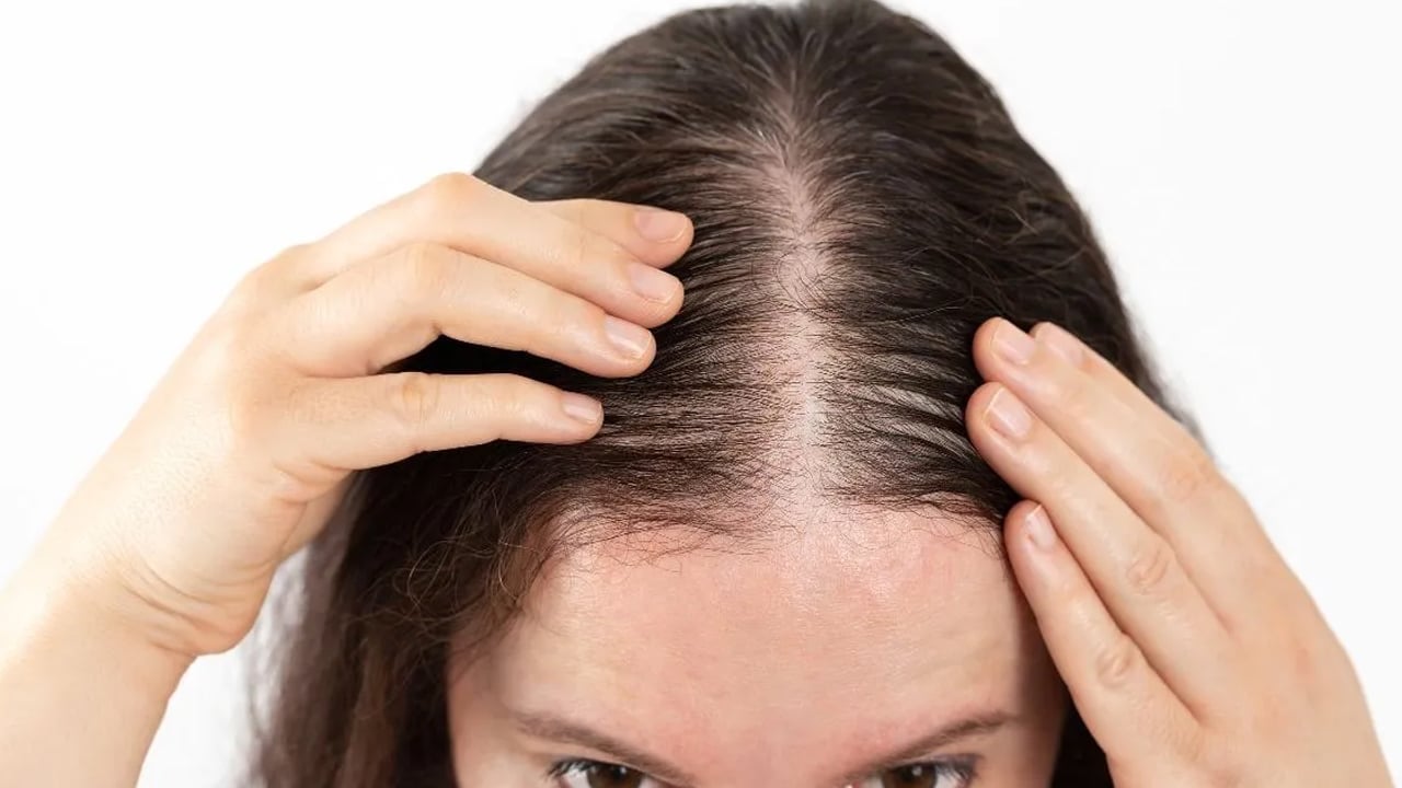 Foto - Canan Karatay ısrarla öneriyor: Saç dökülmesi genetik değil! Uzman isimden o ilgili uyarı yapıldı