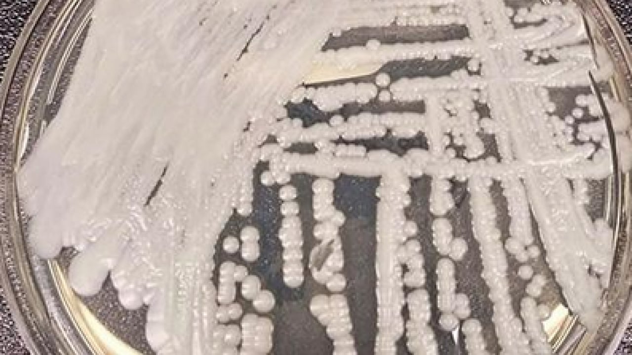 Foto - Candidozyma auris adlı mantara karşı ciddi çalışma! Mantarların çoğalma ve iletişim mekanizmaları... 