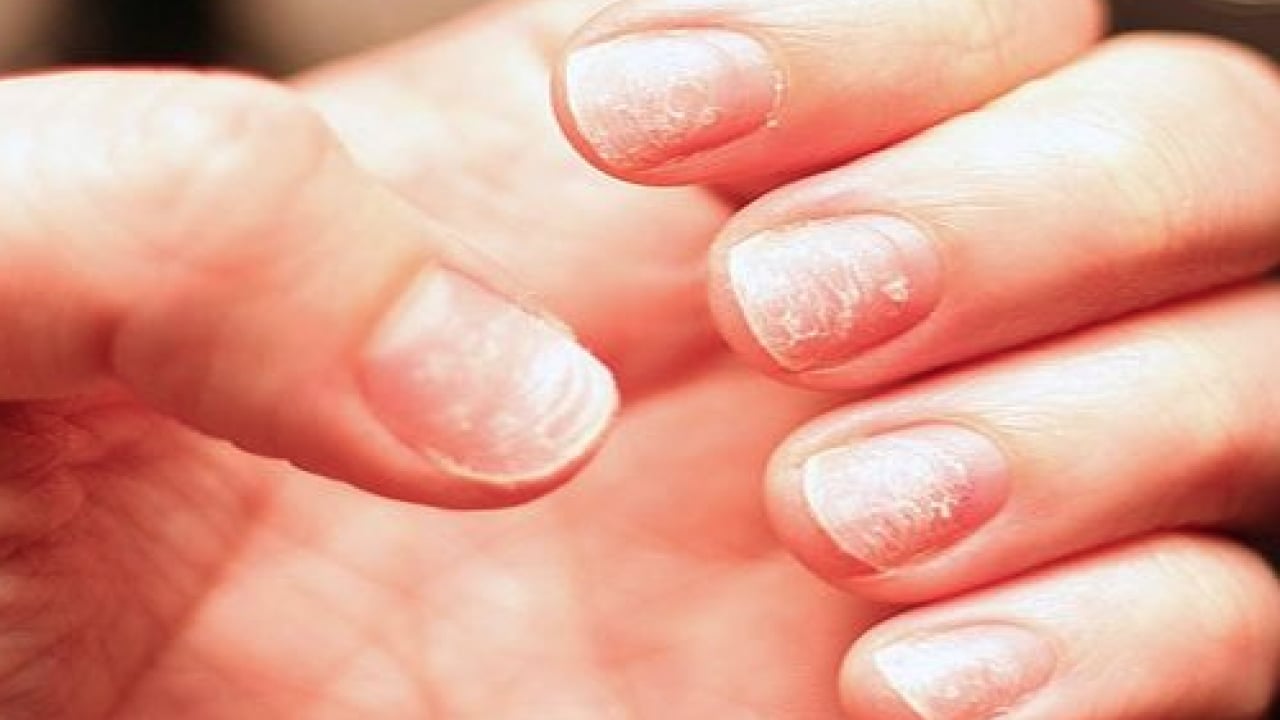 Foto - Çay, kahve ve süt ürünlerinden... Demir takviyesi mideyi rahatsız eder mi?