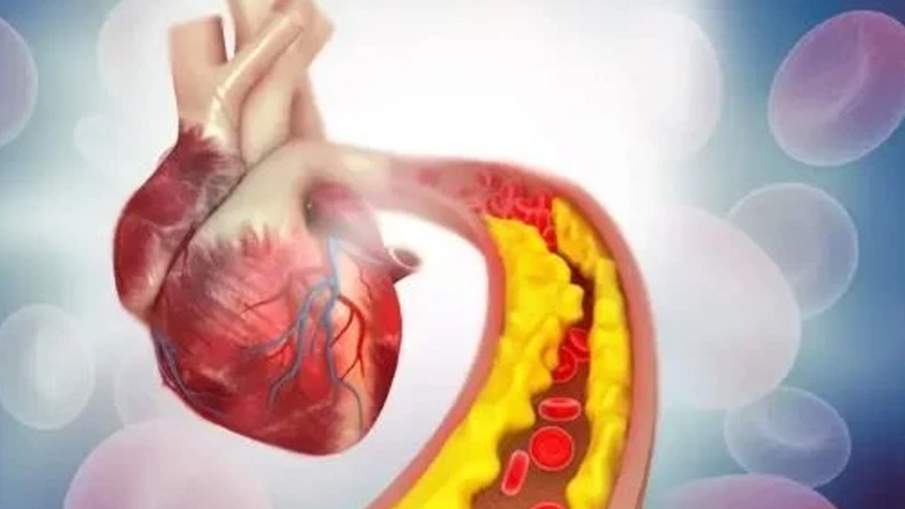 Foto - Sadece sabahları aç karnına tüketin! Zerdeçal çayı tarifi nasıl yapılır? Bu çay öyle bir şey yapıyor ki...