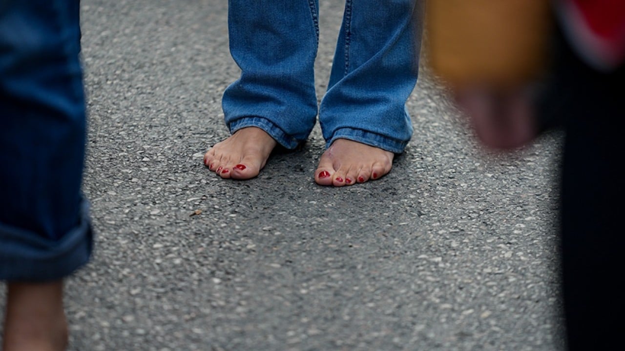 Foto - CHP yüzünden kafayı yediler