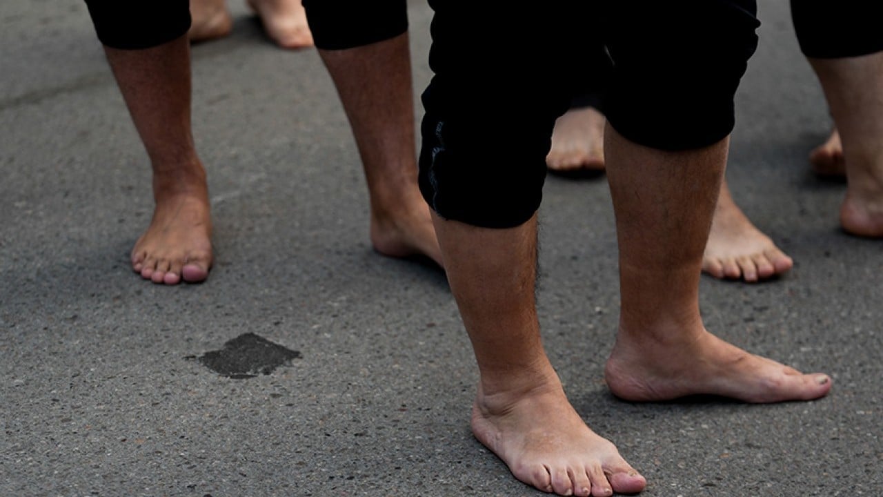 Foto - CHP yüzünden kafayı yediler