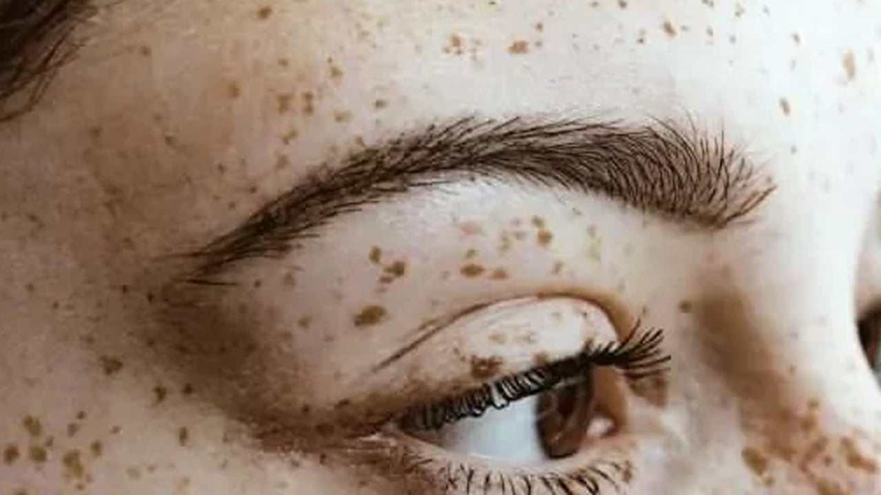 Foto - Cildi porselen gibi yapıyor! Ciltte porselen etkisi için 10-15 dakikada yapılan bu karışım 10 yaş gençleştiriyor! 