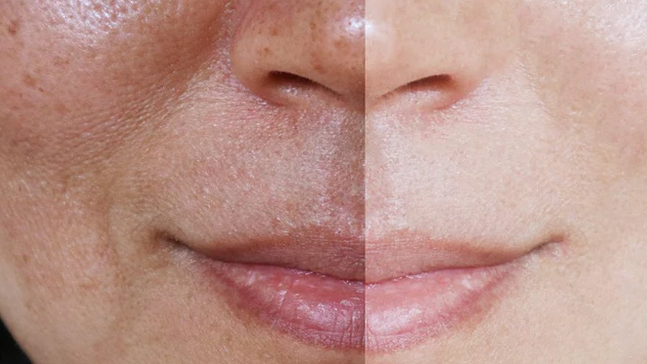 Foto - Cildi porselen gibi yapıyor! Ciltte porselen etkisi için 10-15 dakikada yapılan bu karışım 10 yaş gençleştiriyor! 