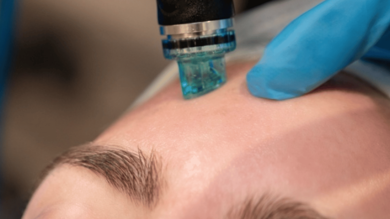 Foto - Cildinizi yoğun temizlikle meşgul etmeyin, nazik bir şekilde koruyun uyarısı!