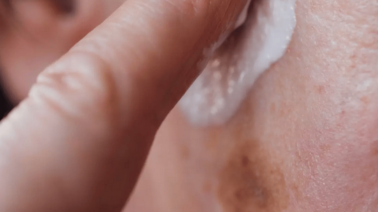 Foto - Cilt lekelerinin doğal açıcısı bu yöntem: Evde uygulayın kararmaları yok edin...