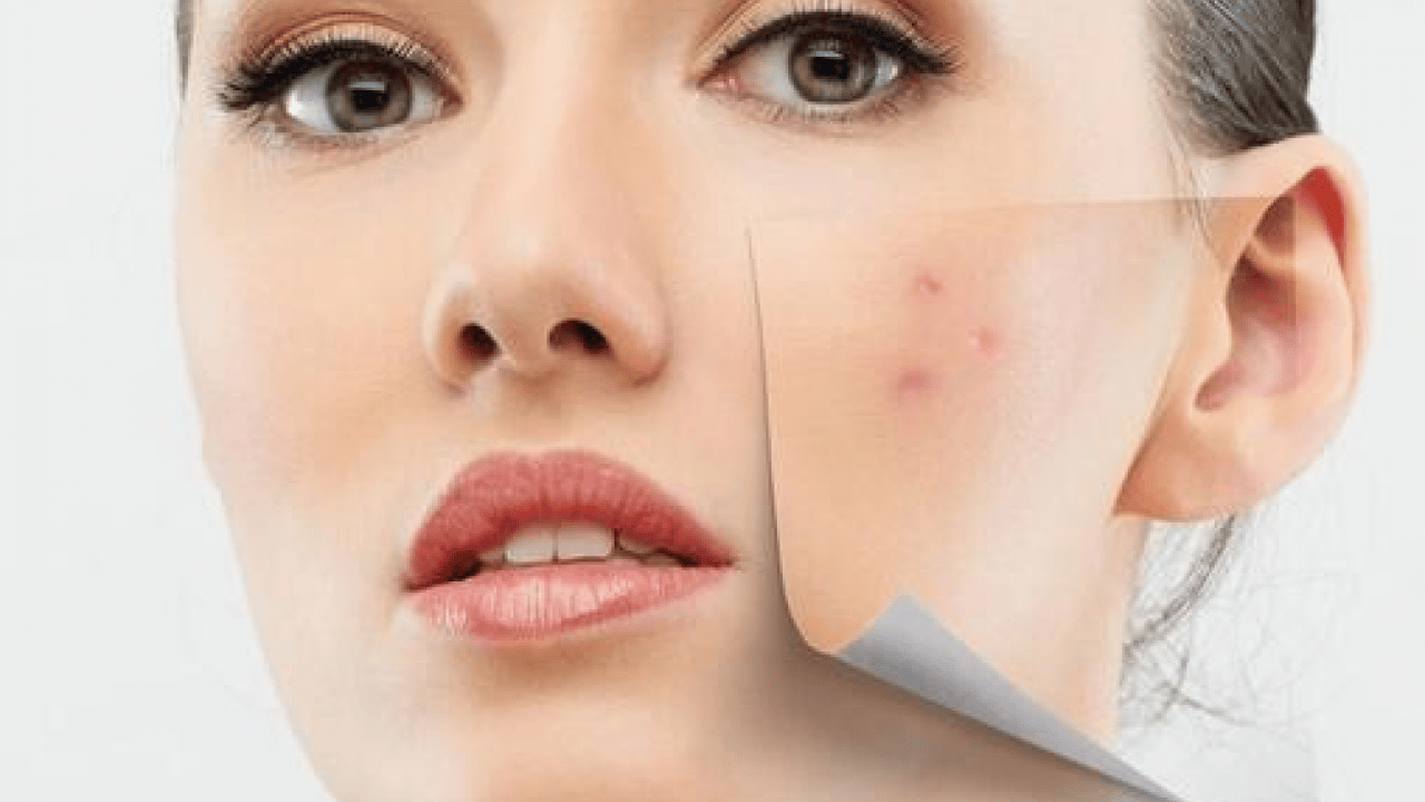 Foto - Cilt lekelerinin doğal açıcısı bu yöntem: Evde uygulayın kararmaları yok edin...