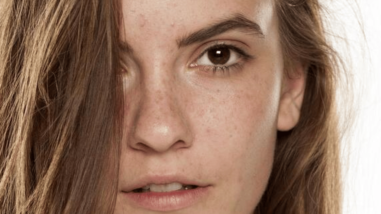 Cilt lekelerinin doğal açıcısı bu yöntem: Evde uygulayın kararmaları yok edin...