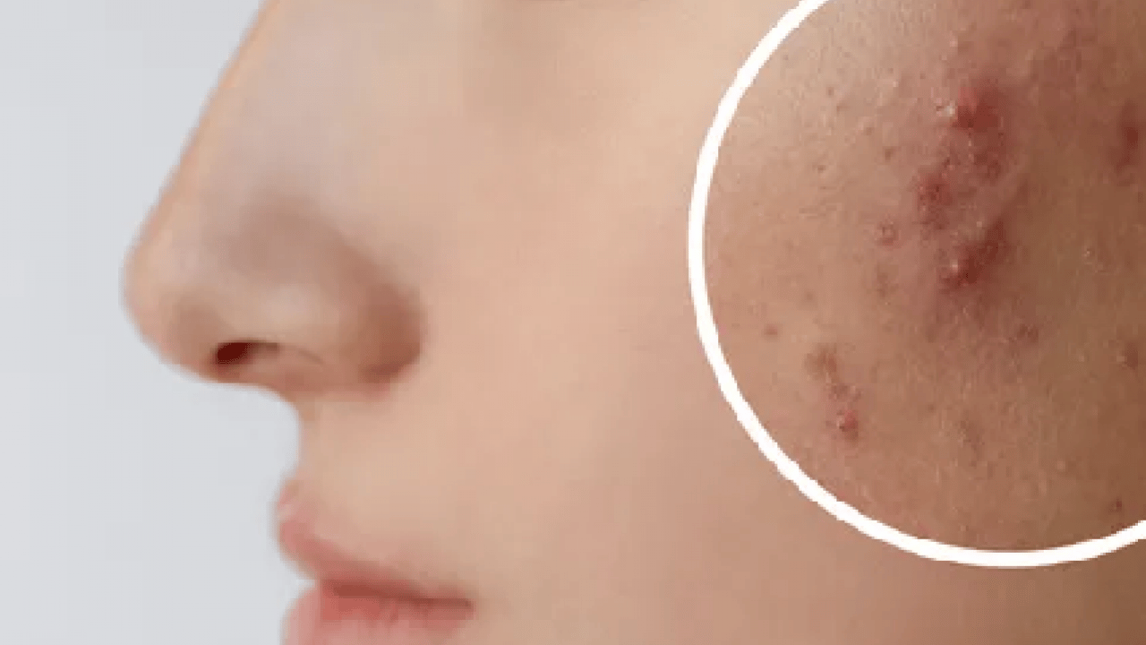 Foto - Ciltteki kolajen yıkımını durduruyor! Faydaları saymakla bitmiyor! Cilt bakım rutini mi?