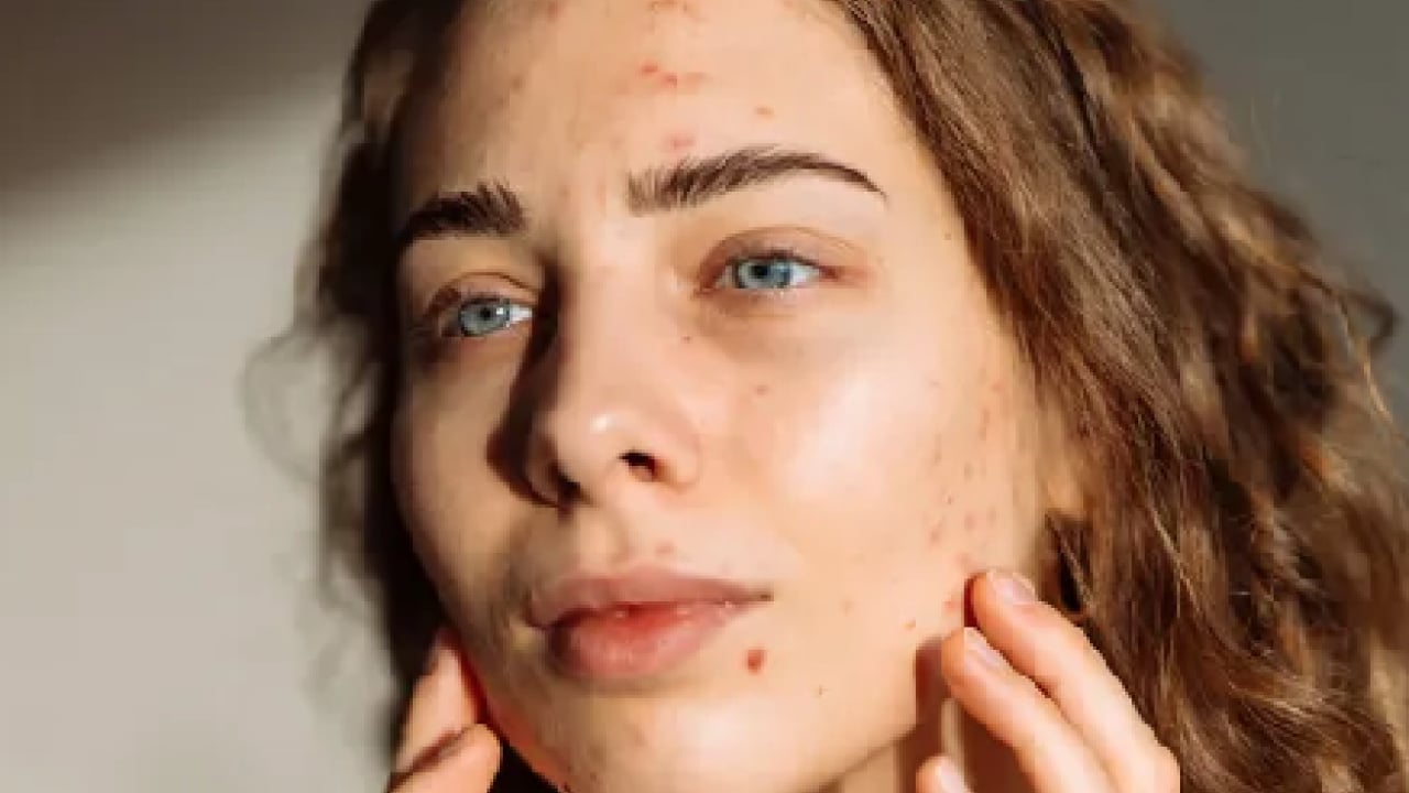 Foto - Ciltteki kolajen yıkımını durduruyor! Faydaları saymakla bitmiyor! Cilt bakım rutini mi?