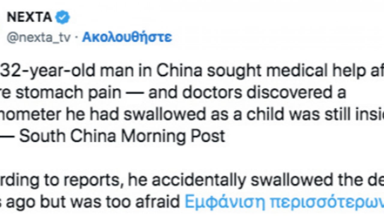 Foto - Çin'in gazetesi duyurdu: Doktorlar gördüğüne inanamadı! 20 yıl karnında termometre ile yaşadı