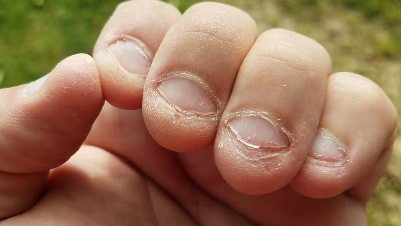 Foto - Çocuk tırnak yiyorsa o davranışların bile nedeni var! Uzmanı uyardı: Kimsenin aklına gelmez