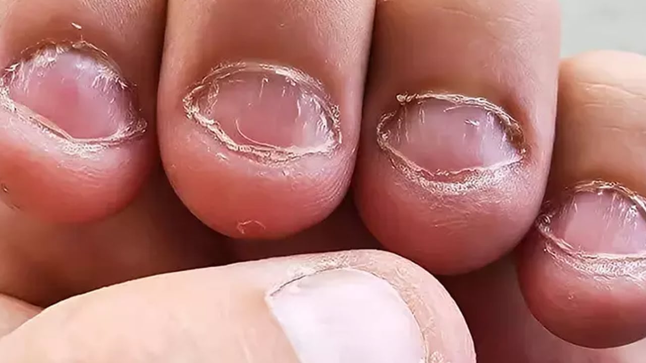 Foto - Çocuk tırnak yiyorsa o davranışların bile nedeni var! Uzmanı uyardı: Kimsenin aklına gelmez