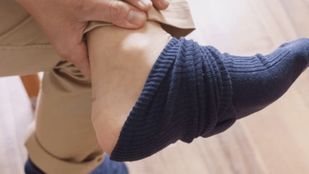 Foto - Çoğu zaman fark edemiyorsunuz ama... Çorap izi deyip geçmeyin