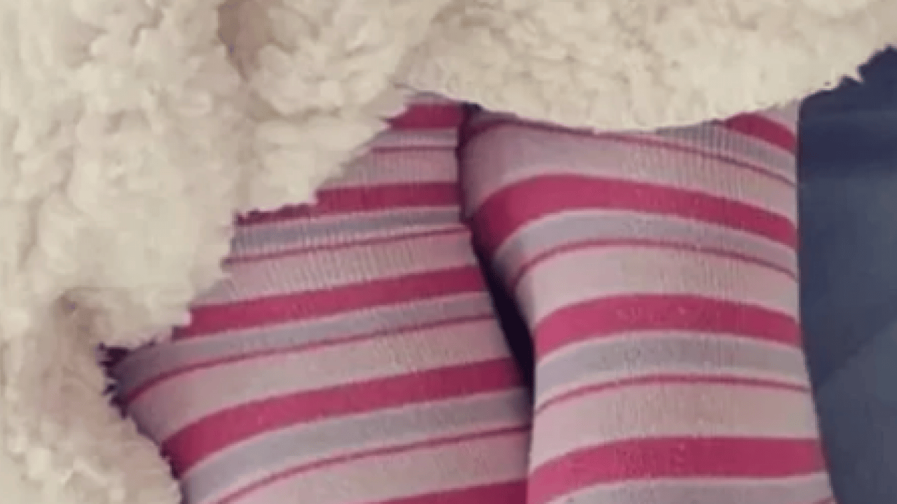 Foto - Çoğu zaman fark edemiyorsunuz ama... Çorap izi deyip geçmeyin