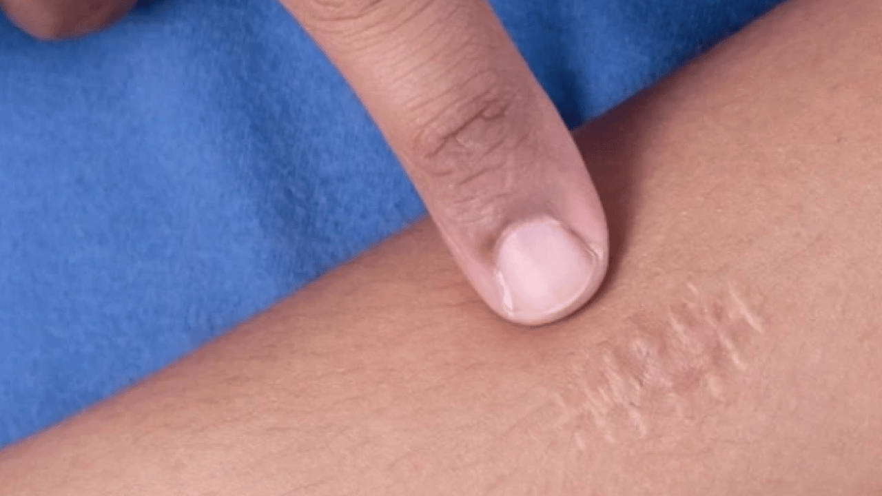 Foto - Çoğu zaman fark edemiyorsunuz ama... Çorap izi deyip geçmeyin