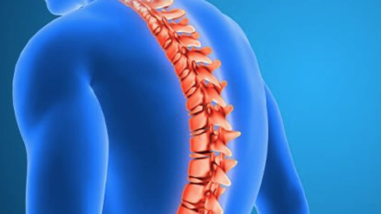 Foto - Çok büyük hastalıklara sebebiyet verebilir! Skolyoz uyarısına kulak verin...