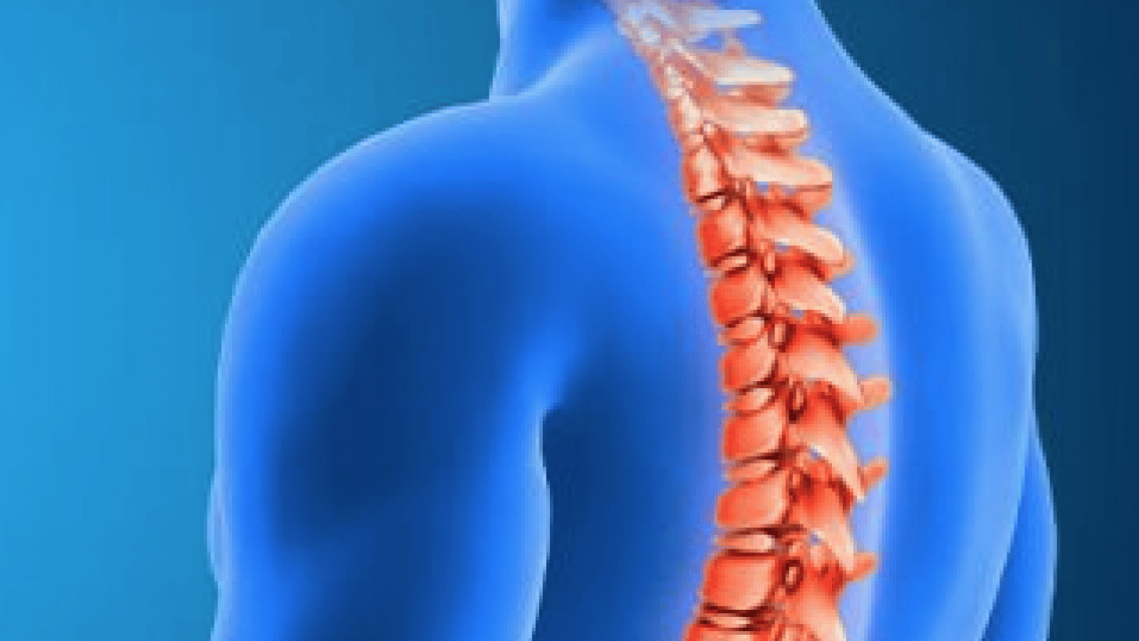 Foto - Çok büyük hastalıklara sebebiyet verebilir! Skolyoz uyarısına kulak verin...