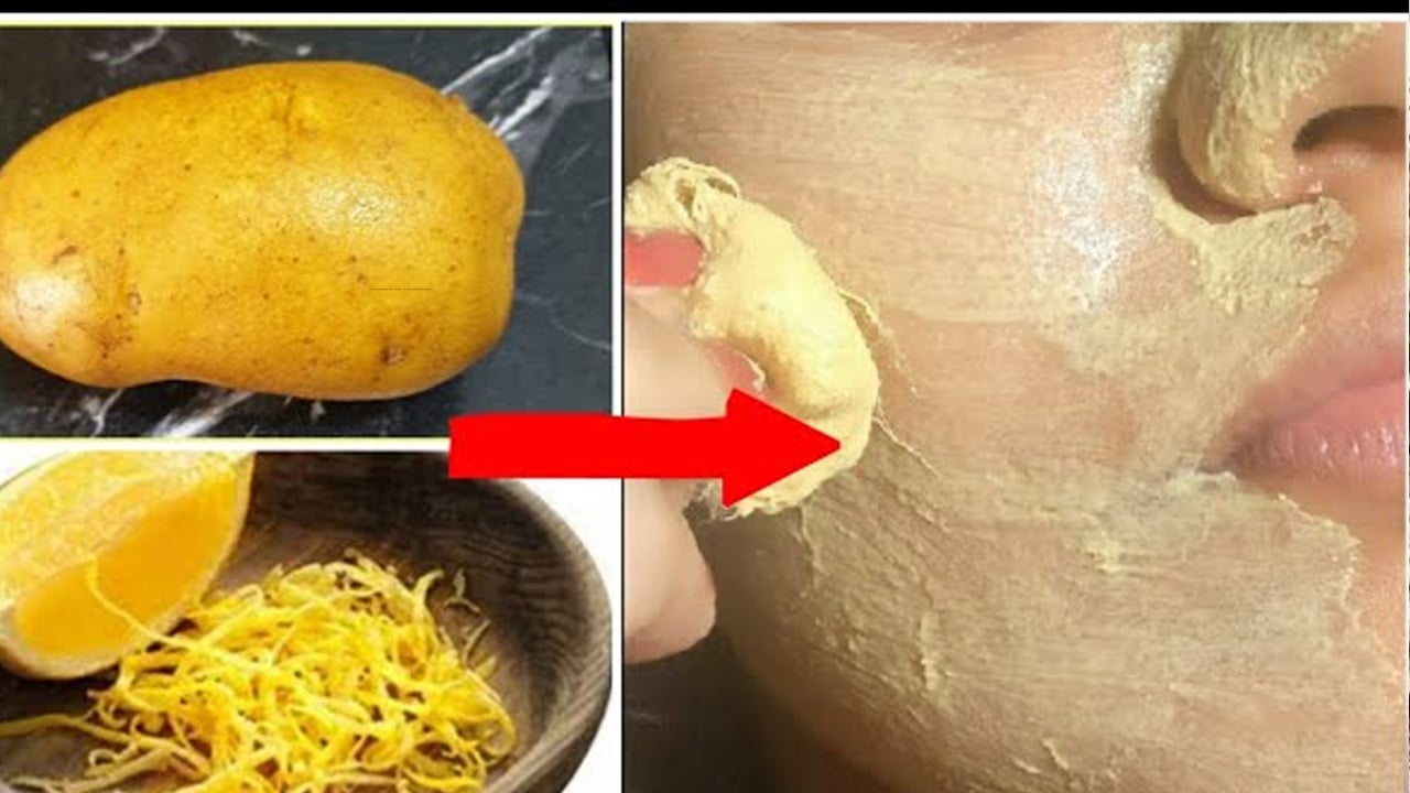 Foto - Çöpe atan pişman olur! Patates kabuklarını dev yapan kullanım yolları! Göz altı torbalarına bunu yapın!