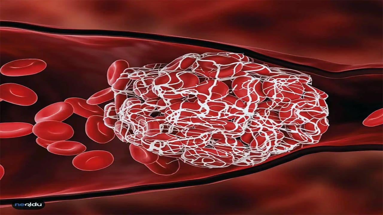 Foto - Covid 19 aşıları sonrası kan pıhtılaşması! Gizem sonunda çözüldü