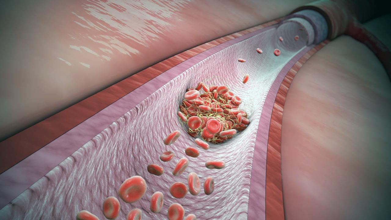 Foto - Covid 19 aşıları sonrası kan pıhtılaşması! Gizem sonunda çözüldü