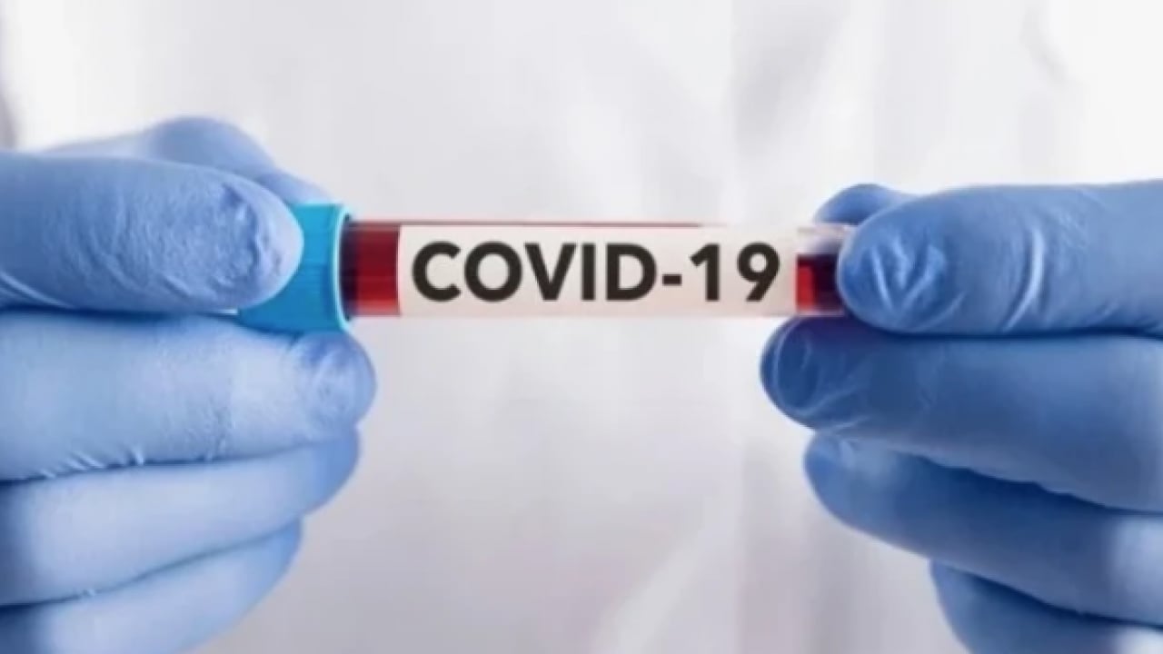 Foto - COVID-19 neden bazı insanlarda daha yıkıcı oldu? Bilim insanları resmen açıkladı... 