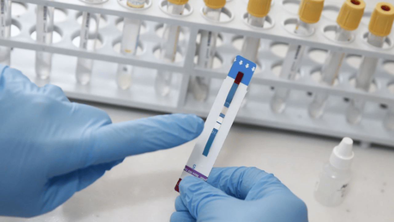 Foto - Covid-19 pandemisinde aşı iki can almıştı! Sebebi ortaya çıktı