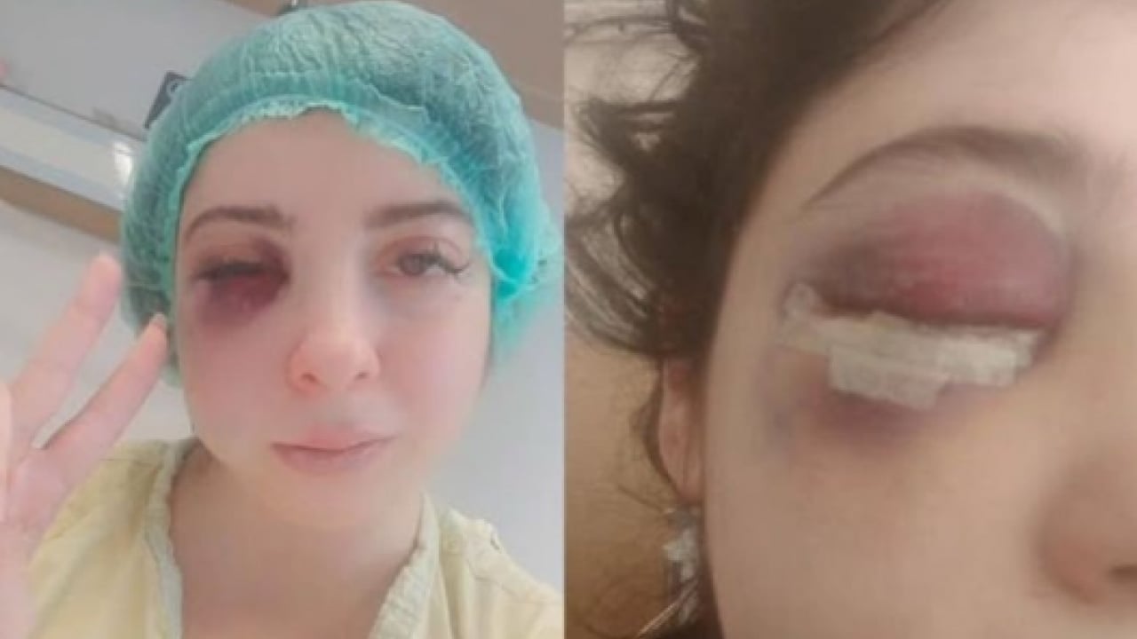 Foto - Damla Korkmaz’ı darbeden saldırgana 3 yıl 8 ay hapis: Sokak ortasında taciz edip dövmüştü 