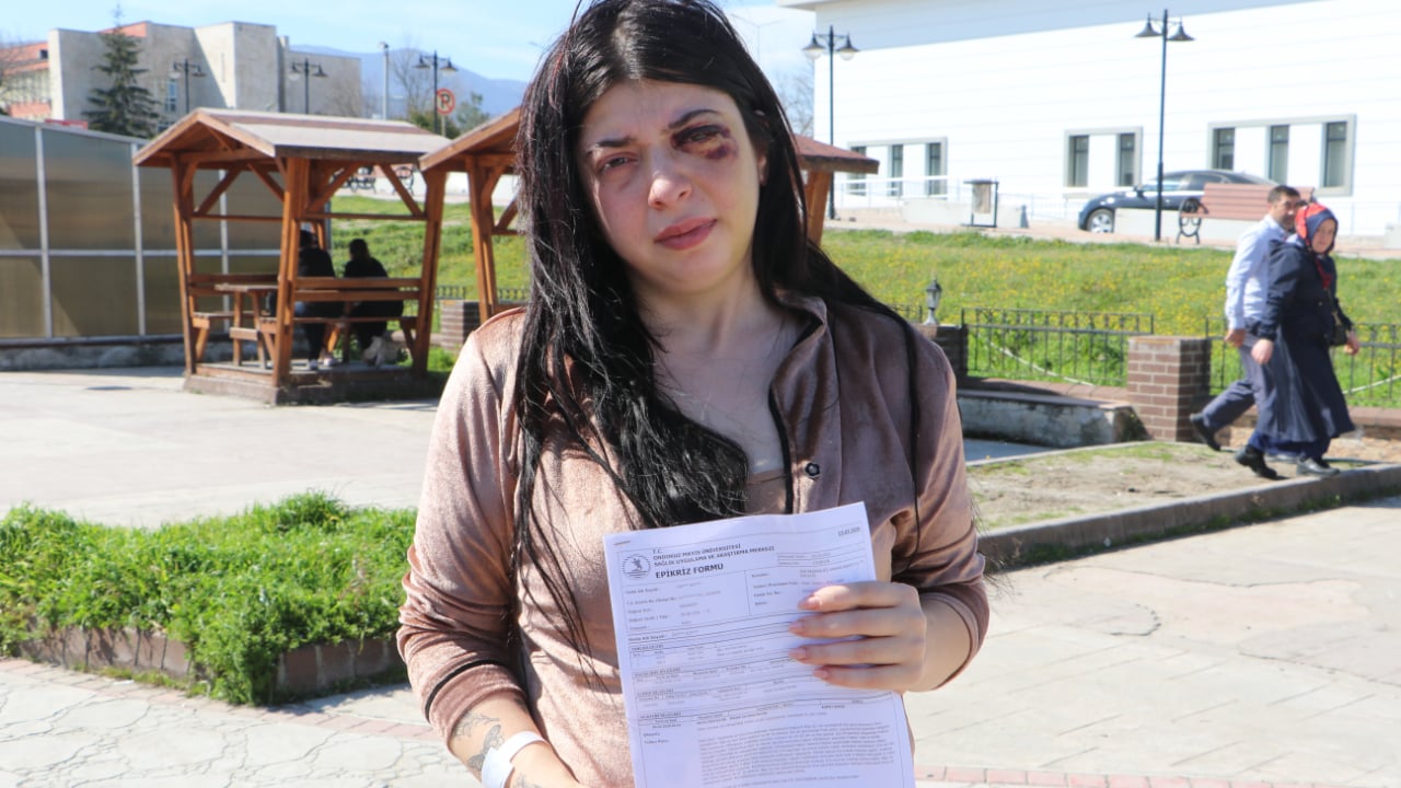 Foto - Damla Korkmaz’ı darbeden saldırgana 3 yıl 8 ay hapis: Sokak ortasında taciz edip dövmüştü 