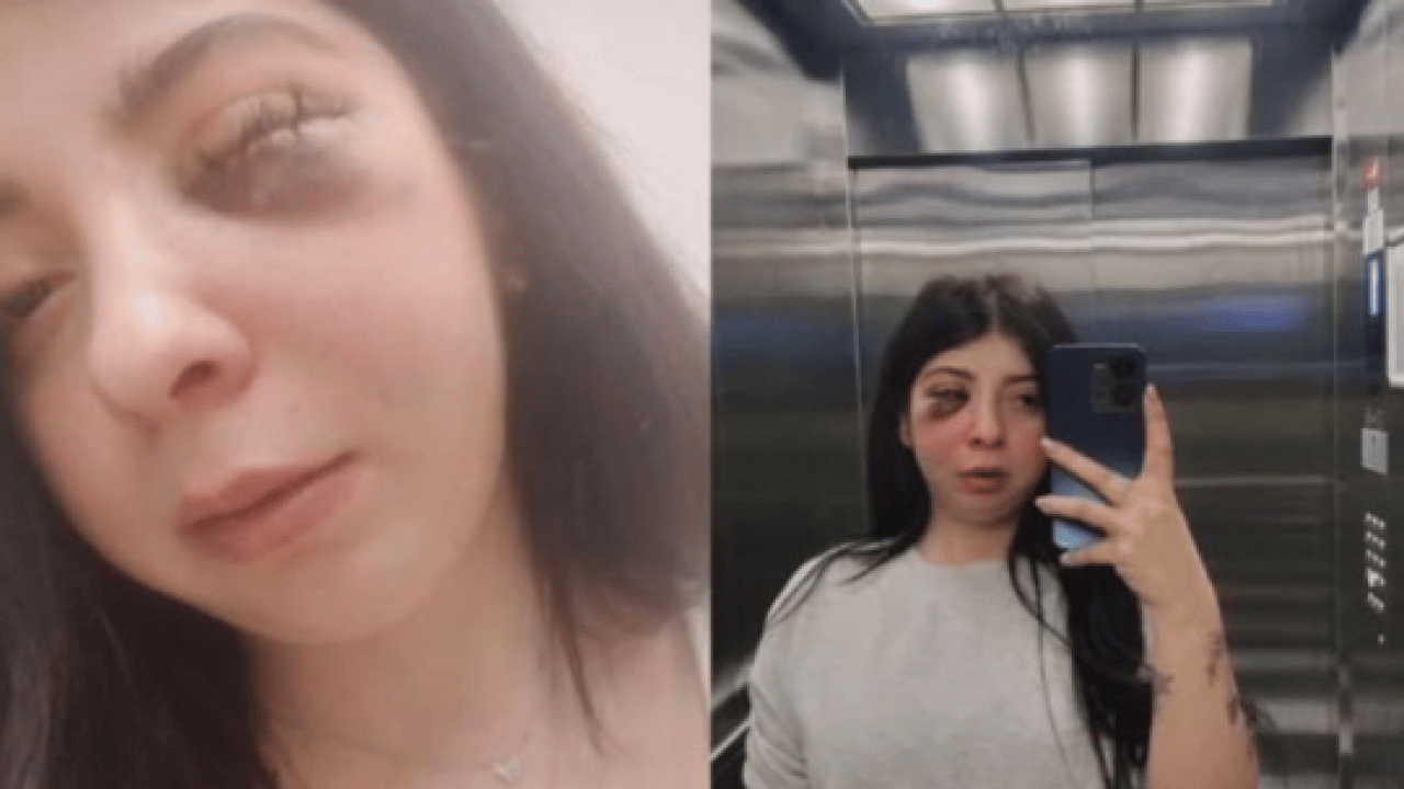 Foto - Damla Korkmaz’ı darbeden saldırgana 3 yıl 8 ay hapis: Sokak ortasında taciz edip dövmüştü 