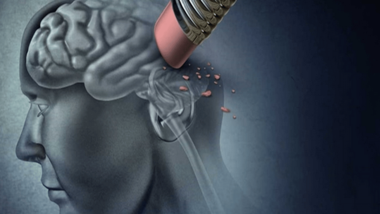 Foto - Demans için Beş ‘erken bunama’ belirtisi açıklandı: Aman dikkat diyelim…