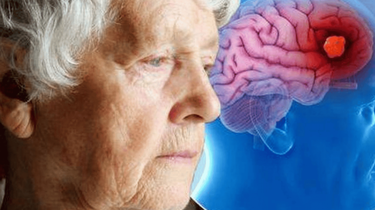 Foto - Demans için Beş ‘erken bunama’ belirtisi açıklandı: Aman dikkat diyelim…