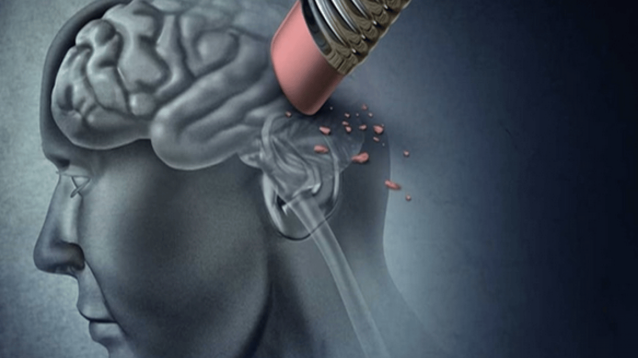 Foto - Demans meğer sadece yaşlılık hastalığı değil! Kimsenin bilmediği gerçek! Herkesin bilmesi gerek